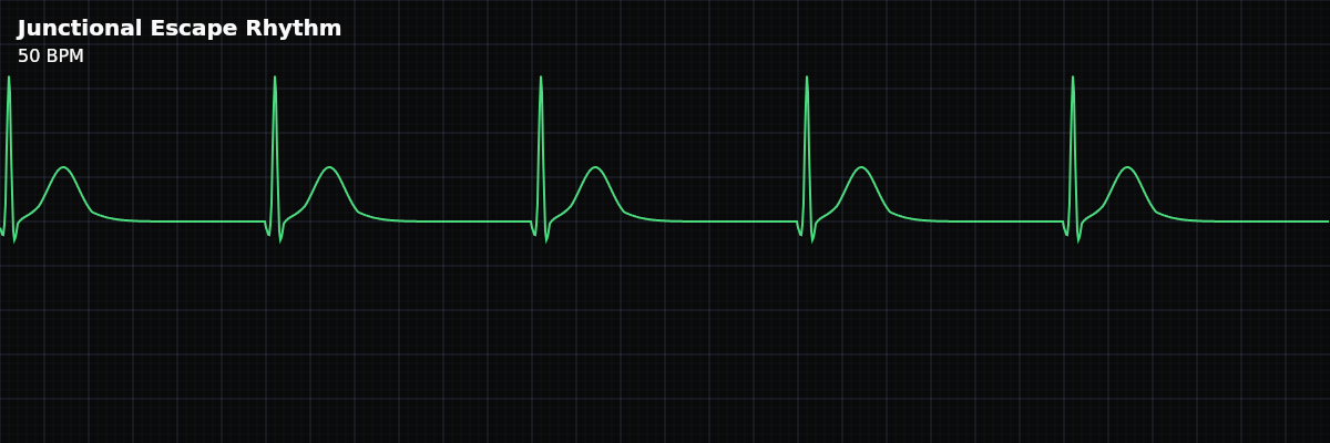 Junctional Escape Rhythm EKG rhythm strip showing A backup rhythm originating from the AV junction when the SA node fails, producing a regular narrow-complex bradycardia at 40-60 BPM. This is a protective mechanism against asystole.